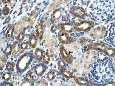 Immunohistochemistry-Paraffin: PKLR Antibody [NBP1-56319]