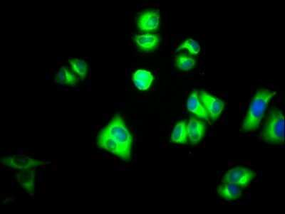 Immunocytochemistry/ Immunofluorescence: PKM2 Antibody (7B2) [NBP3-15230]