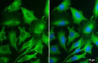 Immunocytochemistry/ Immunofluorescence: PKM2 Antibody (GT1810) [NBP3-13632]