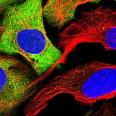 Immunocytochemistry/ Immunofluorescence: PKM2 Antibody [NBP1-82487]