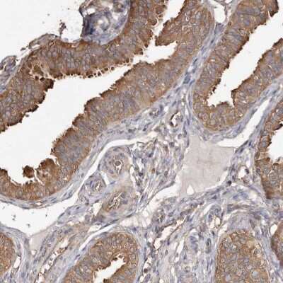 Immunohistochemistry-Paraffin: PKM2 Antibody [NBP1-82487]