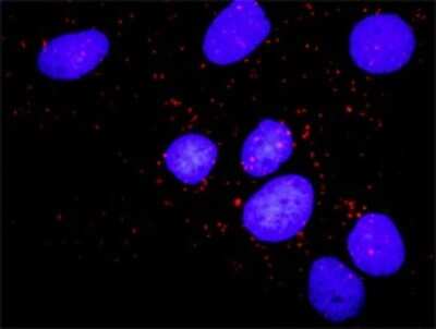 Proximity Ligation Assay: PKMYT1 Antibody (2A3) [H00009088-M03]