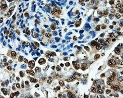Immunohistochemistry-Paraffin: PKMYT1 Antibody (OTI5E1) [NBP2-02275]