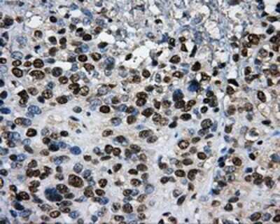 Immunohistochemistry-Paraffin: PKMYT1 Antibody (OTI5E1) [NBP2-02275]