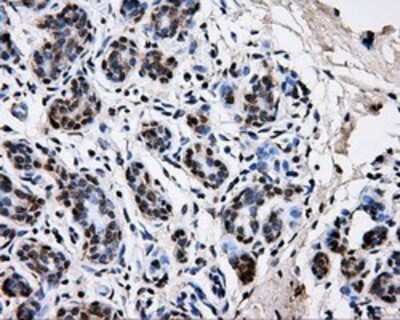 Immunohistochemistry-Paraffin: PKMYT1 Antibody (OTI5E1) [NBP2-02275]
