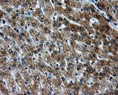 Immunohistochemistry-Paraffin: PKMYT1 Antibody (OTI5E1) [NBP2-02275]