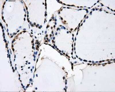 Immunohistochemistry-Paraffin: PKMYT1 Antibody (OTI5E1) [NBP2-02275]