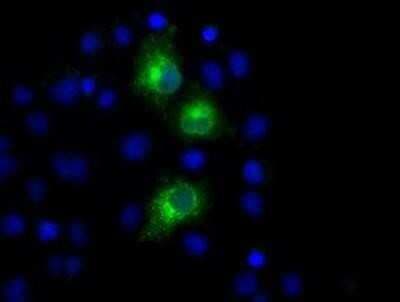 Immunocytochemistry/ Immunofluorescence: PKMYT1 Antibody (OTI5E1) - Azide and BSA Free [NBP2-73452]