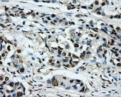Immunohistochemistry: PKMYT1 Antibody (OTI5E1) - Azide and BSA Free [NBP2-73452]