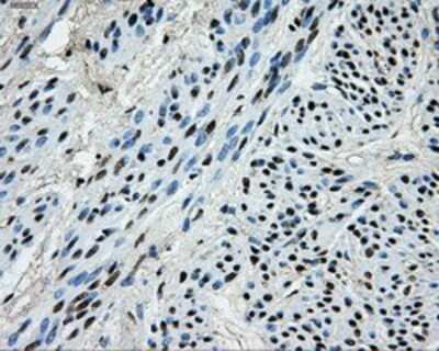 Immunohistochemistry: PKMYT1 Antibody (OTI5E1) - Azide and BSA Free [NBP2-73452]