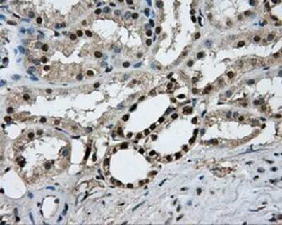 Immunohistochemistry: PKMYT1 Antibody (OTI5E1) - Azide and BSA Free [NBP2-73452]