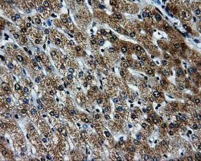 Immunohistochemistry: PKMYT1 Antibody (OTI5E1) - Azide and BSA Free [NBP2-73452]