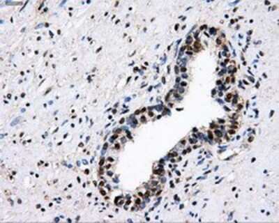 Immunohistochemistry: PKMYT1 Antibody (OTI5E1) - Azide and BSA Free [NBP2-73452]