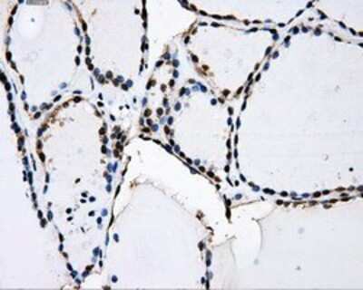 Immunohistochemistry: PKMYT1 Antibody (OTI5E1) - Azide and BSA Free [NBP2-73452]