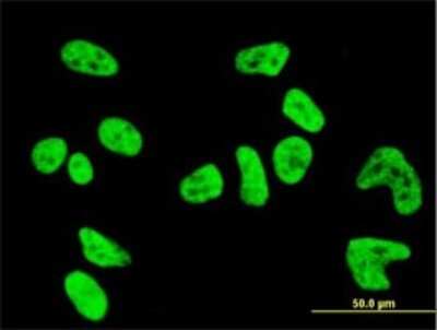 Immunocytochemistry/ Immunofluorescence: PKN1 Antibody (1B10) [H00005585-M01]