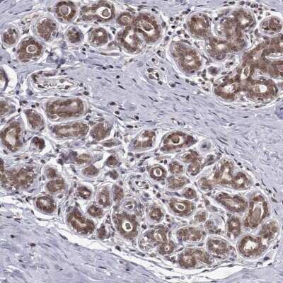 Immunocytochemistry/ Immunofluorescence: PKN2 Antibody [NBP2-68736]