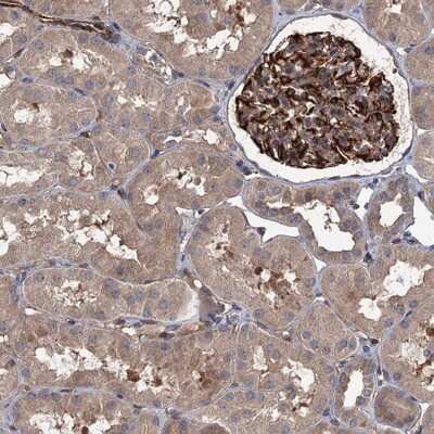 Immunohistochemistry-Paraffin: PKN2 Antibody [NBP2-13766]