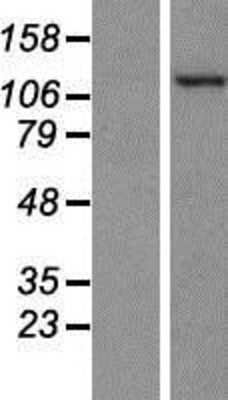 Western Blot: PKN2 Overexpression Lysate [NBP2-07651]