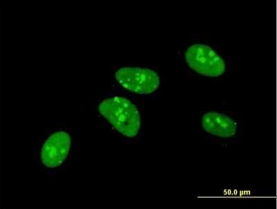 Immunocytochemistry/ Immunofluorescence: PKNOX1 Antibody (2A12) [H00005316-M07]