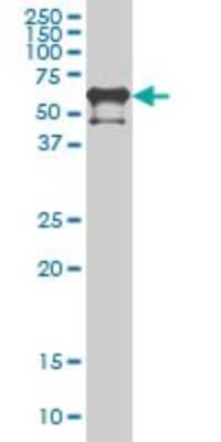 Western Blot: PKNOX2 Antibody (4B6) [H00063876-M01]