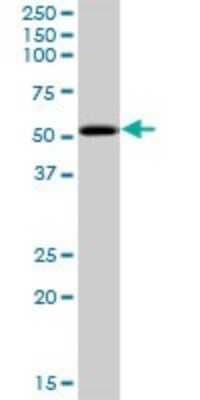 Western Blot: PKNOX2 Antibody [H00063876-B01P]