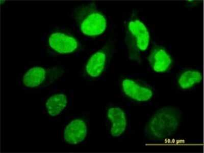 Immunocytochemistry/ Immunofluorescence: PKR Antibody (1D11) [H00005610-M02]