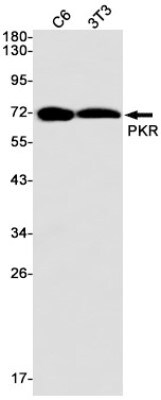 Western Blot: PKR Antibody (S04-3F2) [NBP3-19538]
