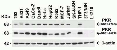 Western Blot: PKR AntibodyBSA Free [NBP1-77266]