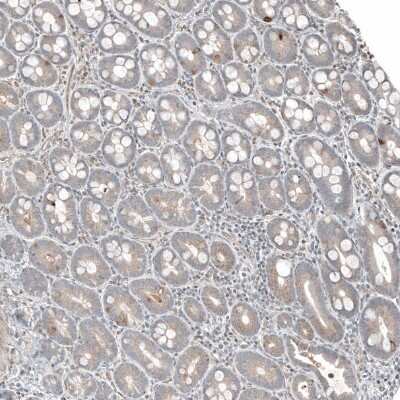 Immunohistochemistry-Paraffin: PLA2G10 Antibody [NBP1-93706]
