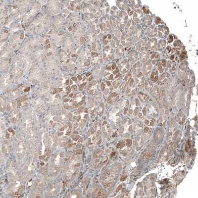 Immunohistochemistry-Paraffin: PLA2G10 Antibody [NBP1-93706]
