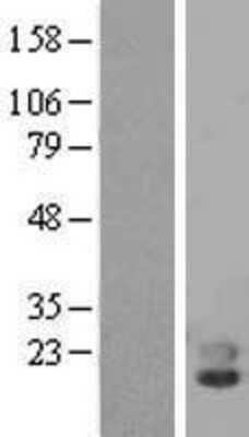 Western Blot: Phospholipase A2 X Overexpression Lysate [NBP2-07985]