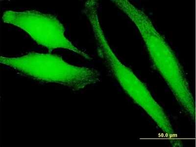 Immunocytochemistry/ Immunofluorescence: PLA2G16/HRASLS3 Antibody [H00011145-B01P]
