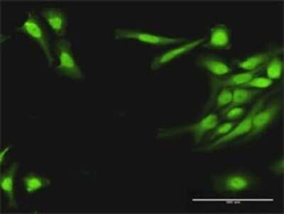 Immunocytochemistry/ Immunofluorescence: PLA2G16/HRASLS3 Antibody [H00011145-D01P]