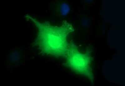 Immunocytochemistry/ Immunofluorescence: PLA2G16/HRASLS3 Antibody (OTI1A5) - Azide and BSA Free [NBP2-73454]