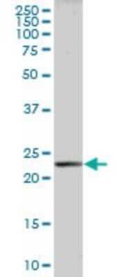 Western Blot: PLA2G16/HRASLS3 Antibody [H00011145-B01P]