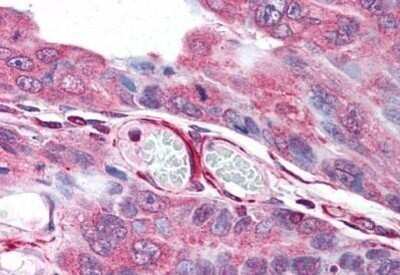 Immunohistochemistry-Paraffin: PLA2G3 Antibody - BSA Free [NB100-59031]