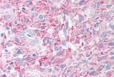 Immunohistochemistry-Paraffin: PLA2G3 Antibody - BSA Free [NB100-59031]