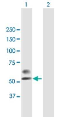 Western Blot: PLA2G3 Antibody [H00050487-B01P]