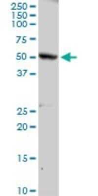 Western Blot: PLA2G3 Antibody [H00050487-D01P]