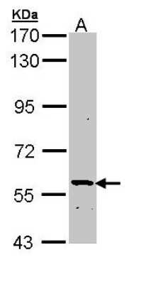 Western Blot: PLA2G3 Antibody [NBP1-33322]