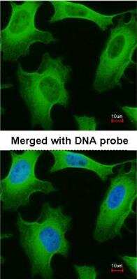 Immunocytochemistry/ Immunofluorescence: PLA2G4A Antibody [NBP1-31344]