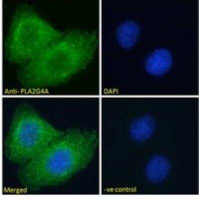 Immunocytochemistry/ Immunofluorescence: PLA2G4A Antibody [NBP1-52050]
