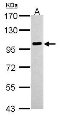 Western Blot: PLA2G4A Antibody [NBP1-31344]