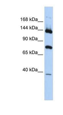 Western Blot: PLA2G4B Antibody [NBP1-80112]