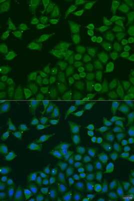 Immunocytochemistry/ Immunofluorescence: PLA2G4C Antibody - BSA Free [NBP2-93545]