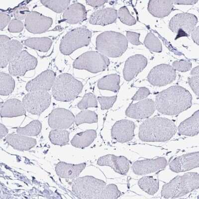 Immunohistochemistry-Paraffin: PLA2G4E Antibody [NBP2-32610]