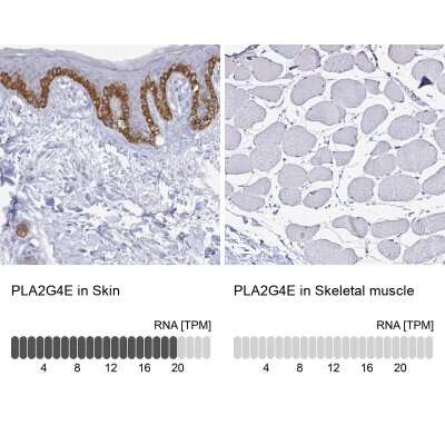 Immunohistochemistry-Paraffin: PLA2G4E Antibody [NBP2-32610]