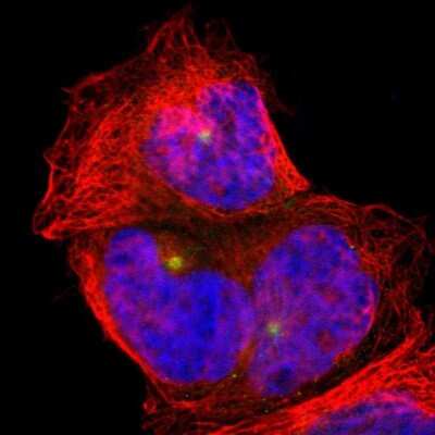 Immunocytochemistry/ Immunofluorescence: PLA2G6 Antibody [NBP1-81586]