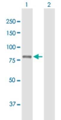 Western Blot: PLA2G6 Antibody [H00008398-B01P]