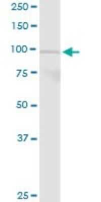 Western Blot: PLA2G6 Antibody [H00008398-D01P]